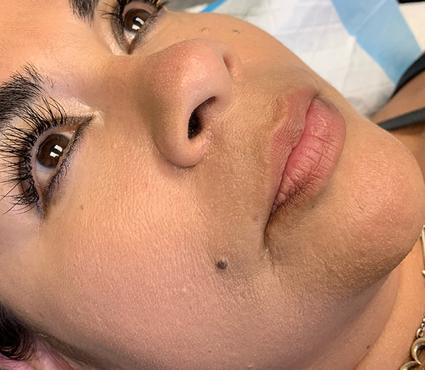 Permanent Makeup Before & After Gallery - Patient 93898075 - Image 1