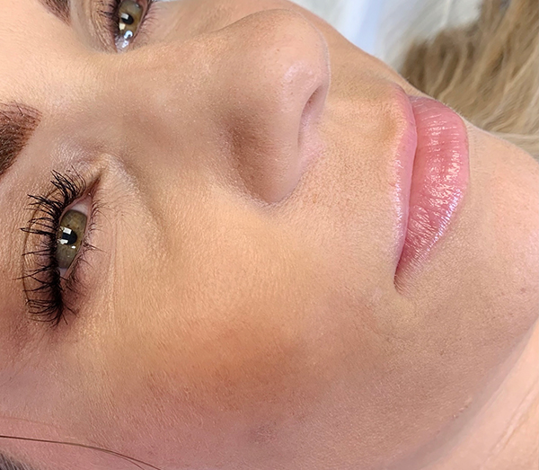 Permanent Makeup Before & After Gallery - Patient 93898094 - Image 1