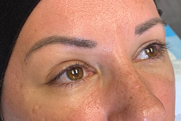 3D Microblading/ Henna Brows Before & After Gallery - Patient 93899387 - Image 1