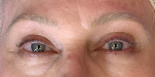 3D Microblading/ Henna Brows Before & After Gallery - Patient 93899695 - Image 1