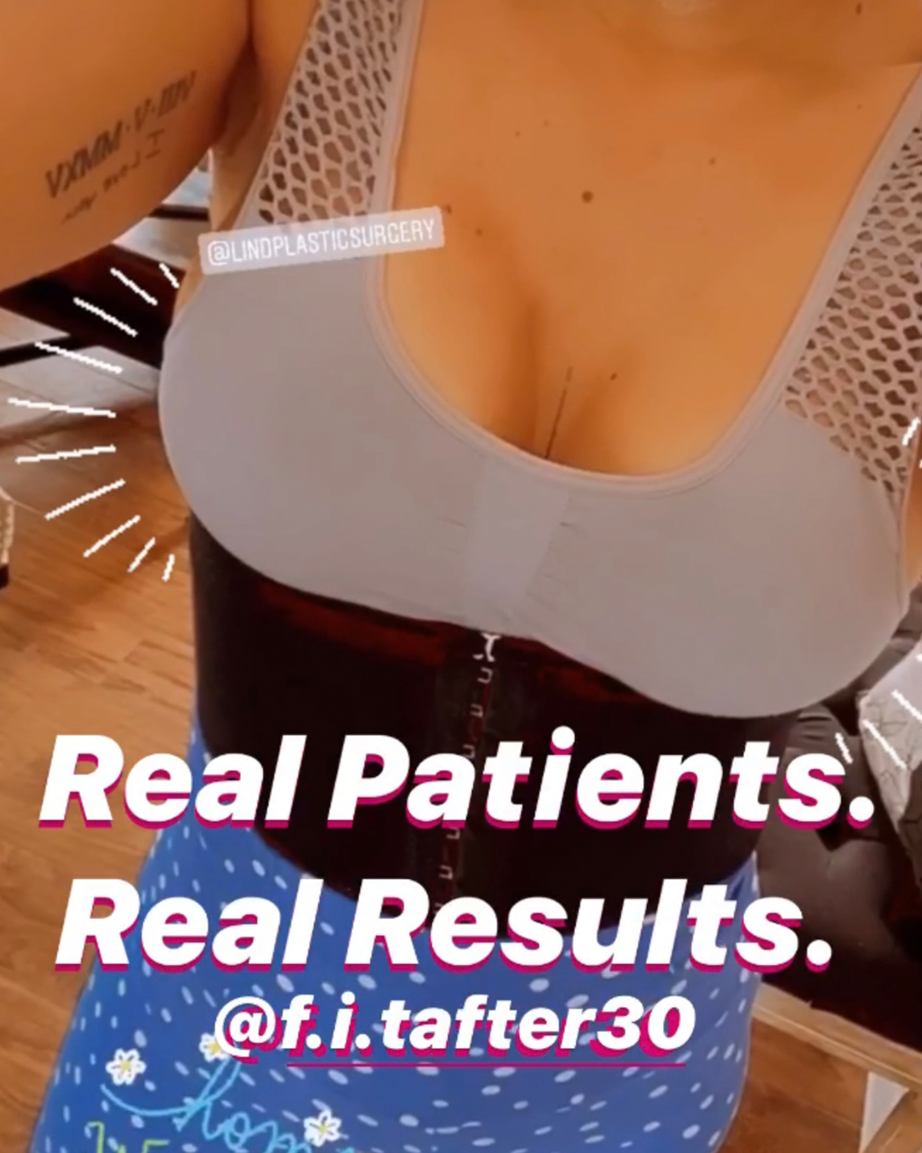 Real Patient Photo - 02